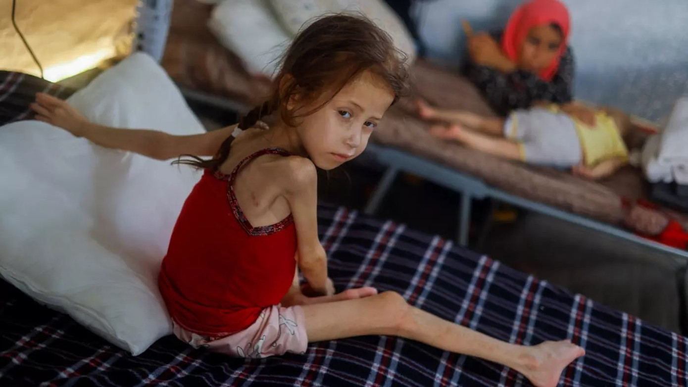 Jana Ayad, một bé gái Palestine bị suy dinh dưỡng, được điều trị tại bệnh viện dã chiến của Quân đoàn Y tế Quốc tế ở phía nam Dải Gaza ngày 22/6/2024. Ảnh: Reuters