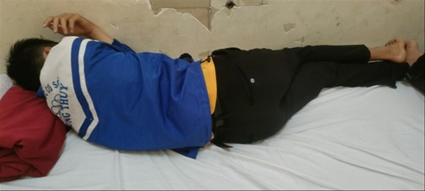 Em V đang được điều trị tại Bệnh viện TƯ Huế Em V đang được điều trị tại Bệnh viện TƯ Huế