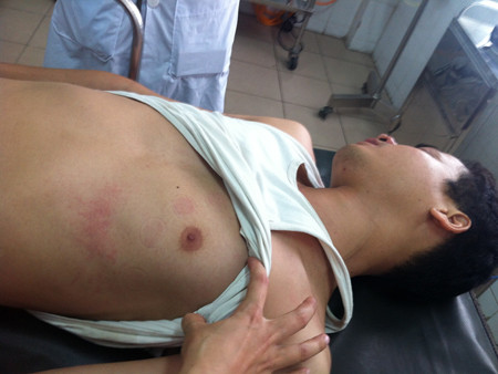 Anh Hải nhập viện sau khi xảy ra sự việc ngày 29/8