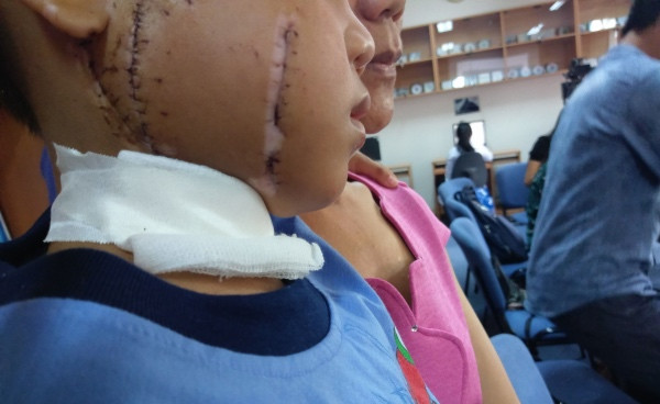 Quạt công nghiệp 'chém' nát mặt bé trai 6 tuổi ảnh 1