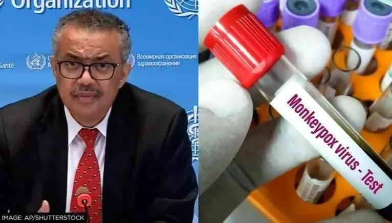WHO đang xem xét việc có nên công bố đợt bùng phát bệnh đậu mùa khỉ là khủng hoảng toàn cầu Ảnh:AP/Shutterstock WHO đang xem xét việc có nên công bố đợt bùng phát bệnh đậu mùa khỉ là khủng hoảng toàn cầu Ảnh:AP/Shutterstock