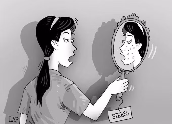 Mụn trứng cá dạng nang: Nguyên nhân và biện pháp khắc phục hiệu quả ảnh 1
