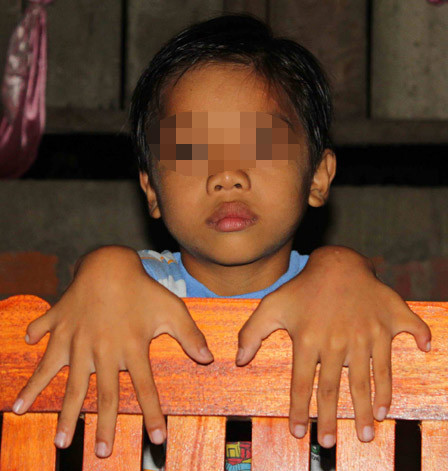  Một cậu bé của 