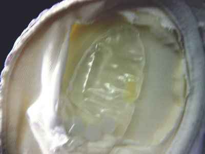 Mẫu dung dịch chứa các hạt lạ, gây rát ngứa