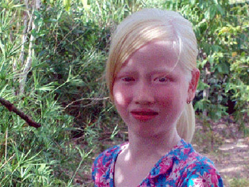 Với bề ngoài đặc biệt, cô bé được người dân địa phương ví von là 