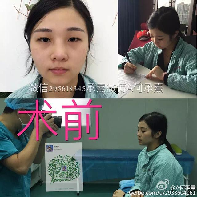 Ảnh khi cô chưa phẫu thuật thẩm mỹ