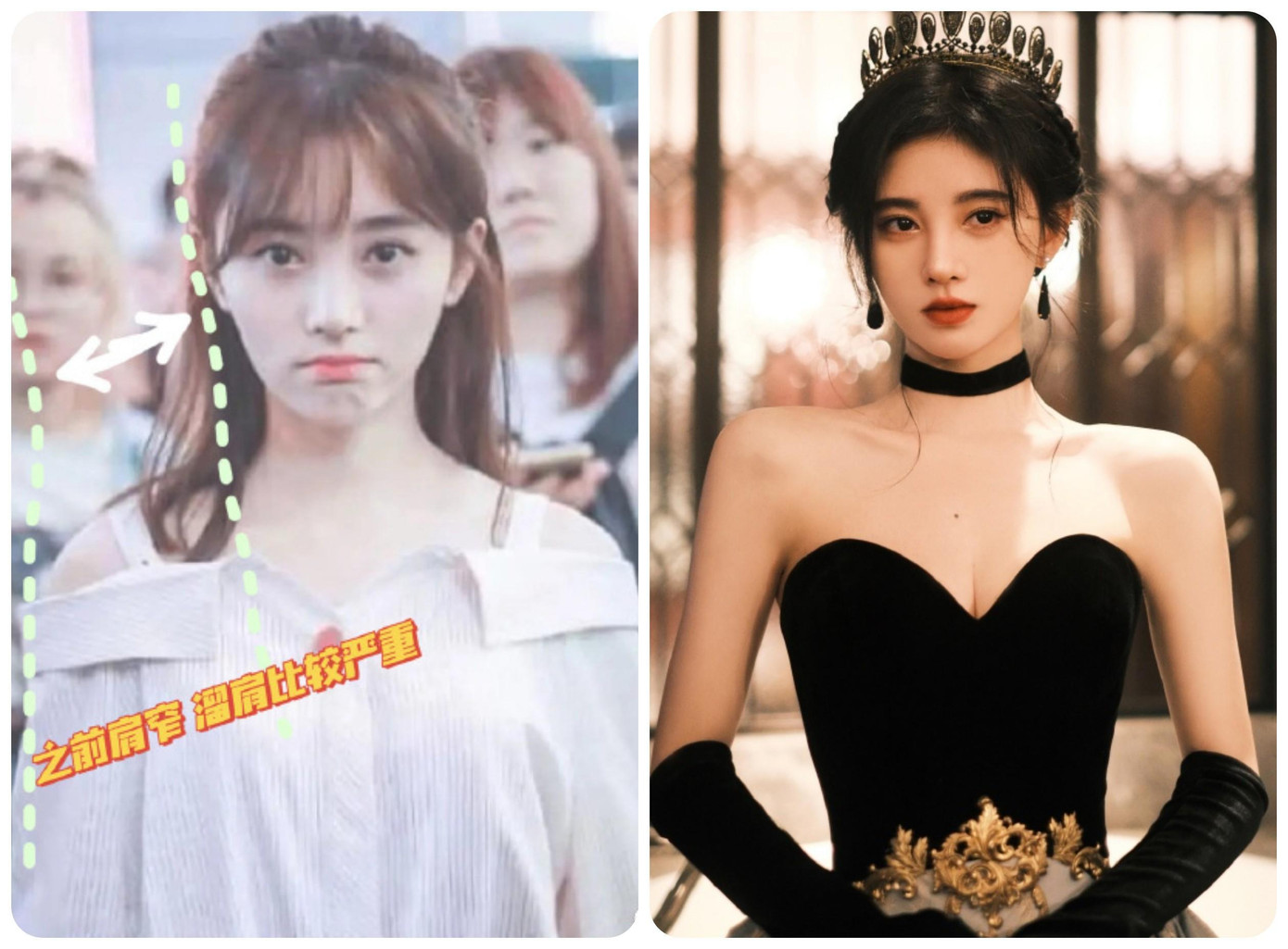 Những ngày vừa qua, khắp các nền tảng mạng xã hội xứ Trung như Sina Weibo, Douban, Douyin,..đều rầm rộ chia sẻ hình ảnh bờ vai của Cúc Tịnh Y dường như đã có sự thay đổi chóng mặt. Trong quá khứ, nữ diễn viên 9x sở hữu đôi vai nhỏ và xuôi khác xa với bờ vai vuông góc ưa nhìn hiện tại.