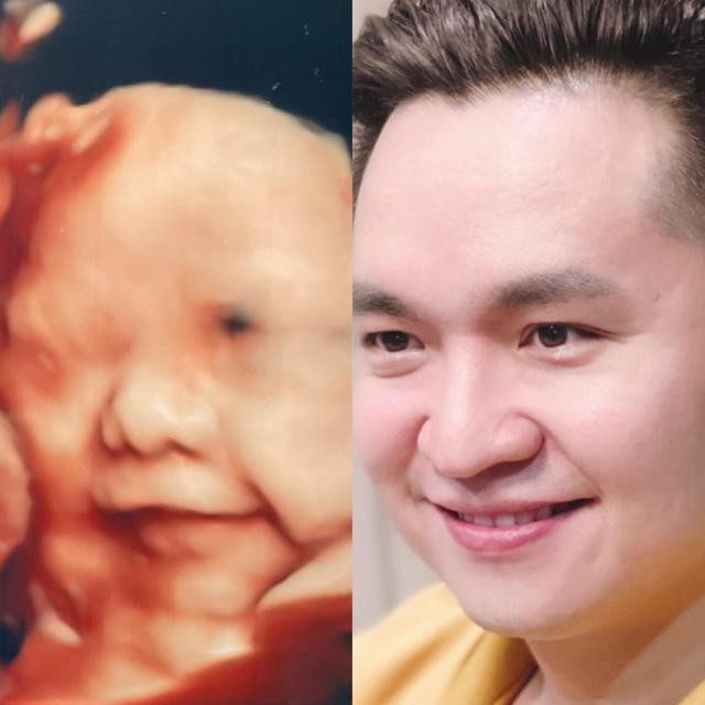 MC ghép hình anh và ảnh siêu âm của em bé