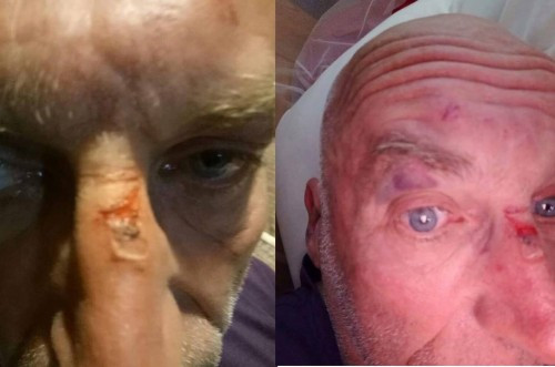 Tin mới vụ 5 thanh niên xô xát với du khách nước ngoài ở Sa Pa ảnh 1