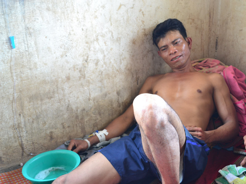 Anh Y Brung đang nằm điều trị tại nhà