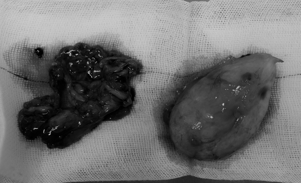 Mang khối u khổng lồ như 'mặt quỷ', người đàn ông 17 năm không dám ra khỏi nhà ảnh 3