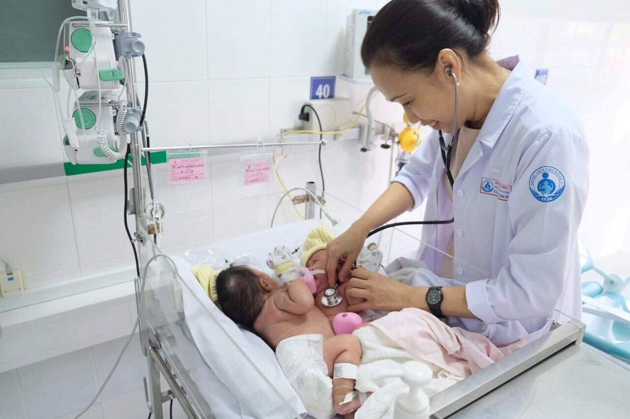 Mổ tách đôi bé song sinh dính liền phần gan ảnh 1