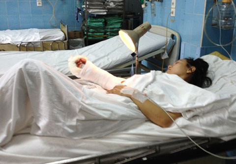 Nạn nhân sau khi được nối bàn tay phải. Ảnh: Quốc Thắng