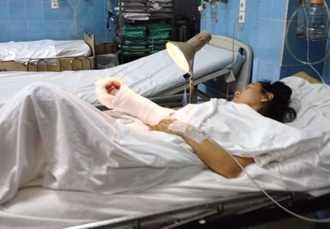 Nạn nhân sau khi được nối bàn tay phải. Ảnh: Quốc Thắng
