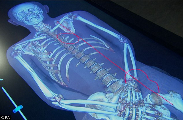 Ảnh chụp X quang thi thể vua Tutankhamun 