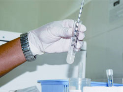 Tinh trùng cho điều trị vô sinh rất hiếm hoi. Ảnh: Thanh Tùng (Thanh Niên)