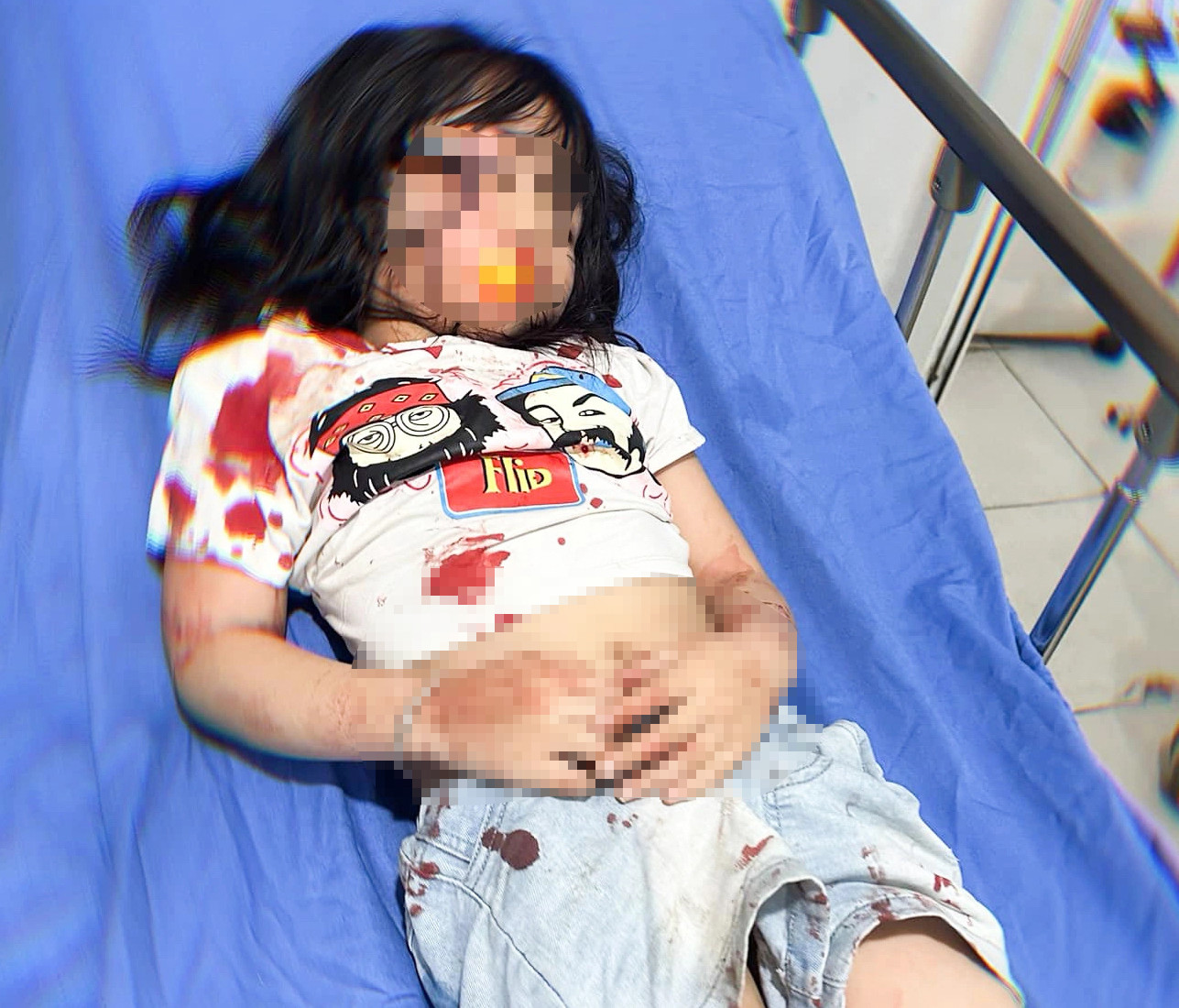 Bé gái được đưa tới bệnh viên cấp cứu sau vụ việc. Bé gái được đưa tới bệnh viên cấp cứu sau vụ việc.