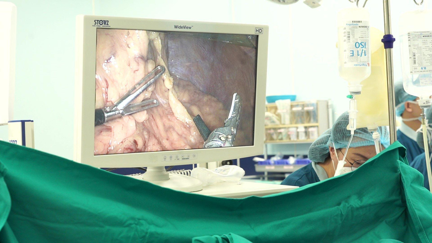 Chỉ bằng 1 đường rạch nhỏ 5-10mm, các bác sĩ đã đưa camera và dụng cụ nội soi vào thực hiện cuộc mổ, trường mổ rộng, rõ ràng, các cấu trúc giải phẫu được phóng đại nhiều lần nên dễ phẫu tích