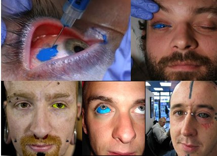 Kinh hãi trào lưu... nhuộm nhãn cầu ảnh 6