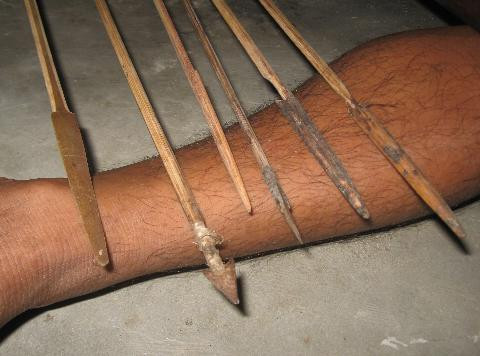 Ngoài việc tẩm độc mũi tên được chế thêm sắt 