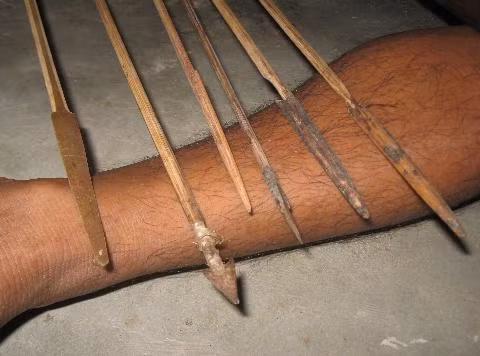 Ngoài việc tẩm độc mũi tên được chế thêm sắt 