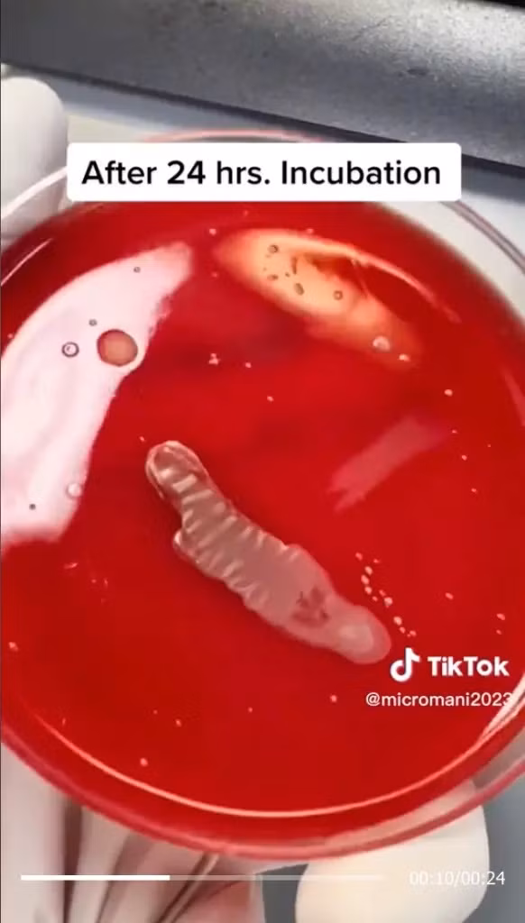 Các thí nghiệm của Abdlrasul được quay video và chia sẻ trên TikTok cho thấy sự phát triển của các vi khuẩn trên các vật dụng sinh hoạt hàng ngày. Các thí nghiệm của Abdlrasul được quay video và chia sẻ trên TikTok cho thấy sự phát triển của các vi khuẩn trên các vật dụng sinh hoạt hàng ngày.
