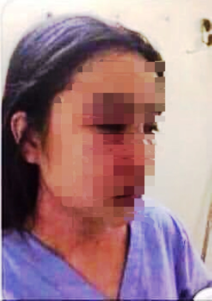 Sức khỏe nữ nhân viên nghi bị bác sĩ Bệnh viện T.Ư Huế hành hung hiện ra sao? ảnh 1