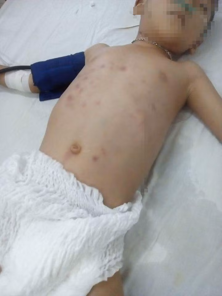 Gia cảnh khốn cùng của bé 6 tuổi bị bạn mẹ đánh thương tật 63% ảnh 2