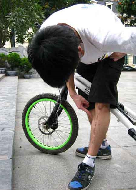 Chi chít những vết sẹo là dấu tích của bao lần bị ngã 