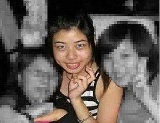 Theo Sina, cô gái 26 tuổi này gần đây đã quyết định trải qua ca phẫu thuật gọt quai hàm bởi vì khuôn mặt của cô trông như hề