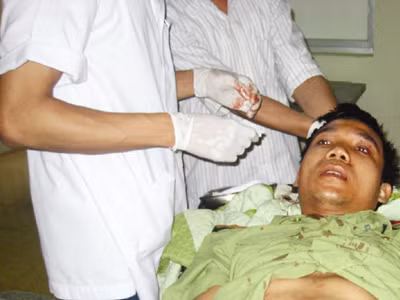 KLV Phan Thanh Long bị chấn thương nặng ở đầu, đang được cứu chữa