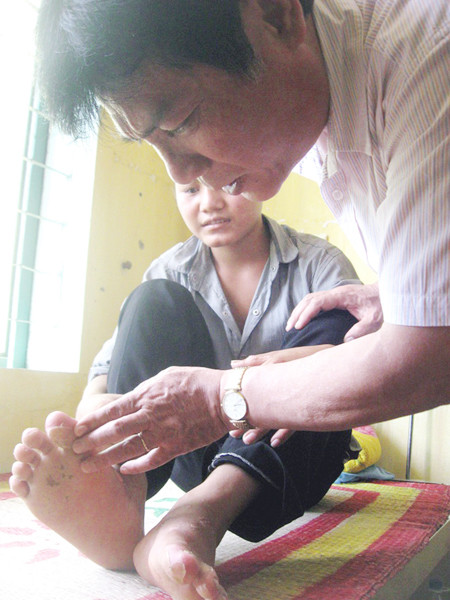 Cục trưởng Cục VSATTP Trần Quang Trung thăm khám bệnh nhân . Cục trưởng Cục VSATTP Trần Quang Trung thăm khám bệnh nhân