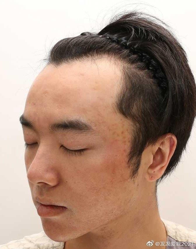 Trị liệu da và phẫu thuật thẩm mỹ. Trị liệu da và phẫu thuật thẩm mỹ.