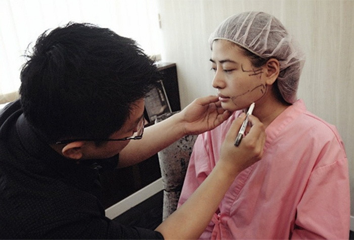 Việc đánh dấu xác định trên khuôn mặt là rất cần thiết. Bác sĩ cho biết, chỉ một chút sai sót có thể khiến bệnh nhân bị liệt cằm, không thể mở và đóng miệng, rối loạn dây thần kinh mặt cùng nhiều biến chứng khác