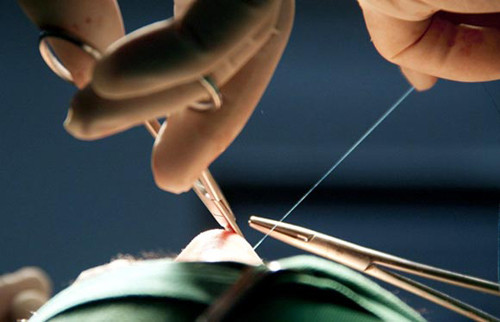 Đã 5 lần thẩm mỹ mà Ca Ca vẫn 