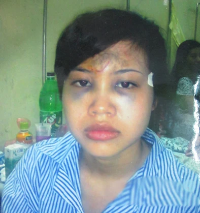 Con gái chủ nhà từng bị nhóm đòi nợ thuê xúm vào đánh bầm tím mặt mày