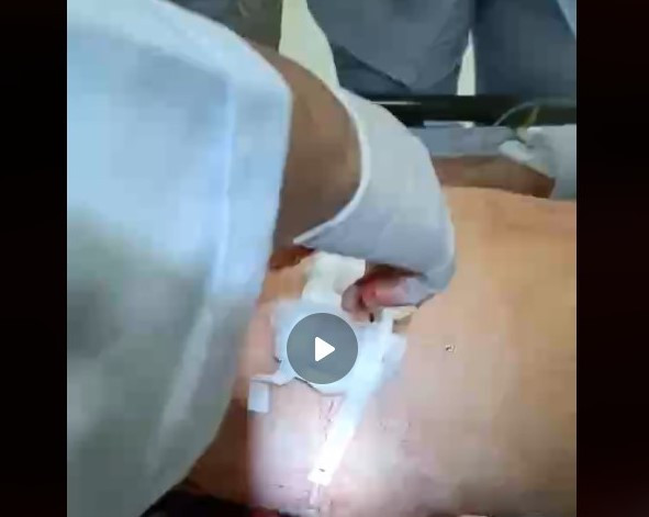 Hai quán nhậu hỗn chiến, 1 người tử vong. Ảnh chụp màn hình. Hai quán nhậu hỗn chiến, 1 người tử vong. Ảnh chụp màn hình.