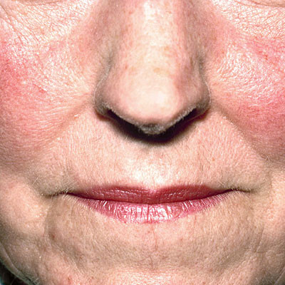 Vẻ bề ngoài nói gì về sức khỏe của bạn?