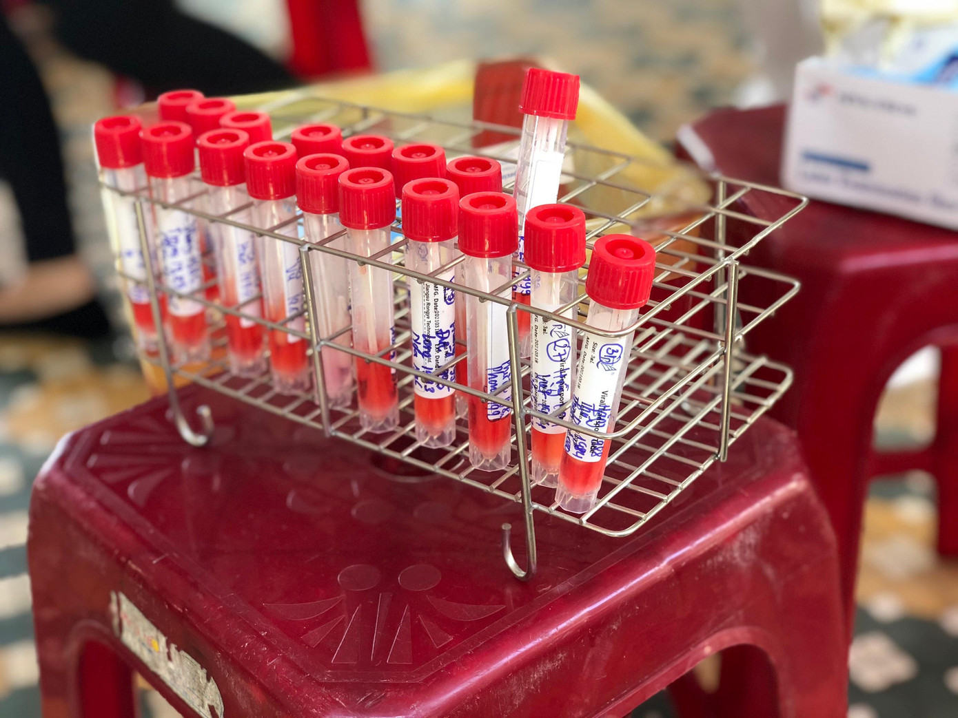 Tại quận Sơn Trà, theo danh sách, dự kiến sẽ có 500 nhân viên của các vũ trường, karaoke, spa, massage, bar, pub trên địa bàn sẽ được lấy mẫu xét nghiệm. Liên quan đến nữ nhân viên vũ trường Phương Đông mắc COVID-19, sáng ngày 7/5 CDC Đà Nẵng cho biết: 448/448 mẫu xét nghiệm của cư dân chung cư 12T3 (nơi nữ nhân viên cư trú) đã có kết quả xét nghiệm lần 1 âm tính với SARS-CoV-2.