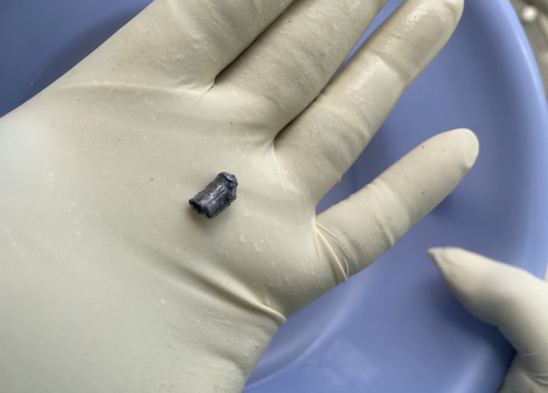 Viên đạn chì được lấy ra từ người nạn nhân.