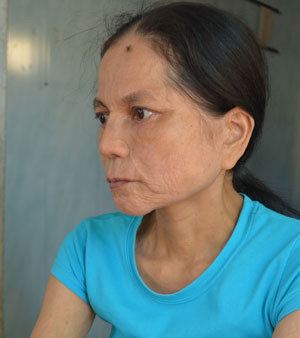 Da chị Mai vẫn nhăn nheo như xưa 