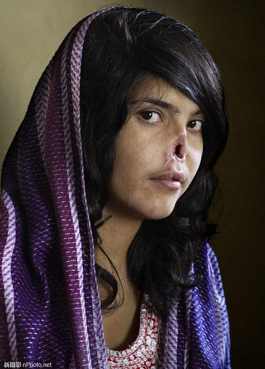 2010: Bibi Aisha, cô gái 18 tuổi ở tỉnh Oruzgan, Afghanistan bị đuổi về nhà cha mẹ đẻ sau khi bị nhà chồng hành hạ tàn nhẫn