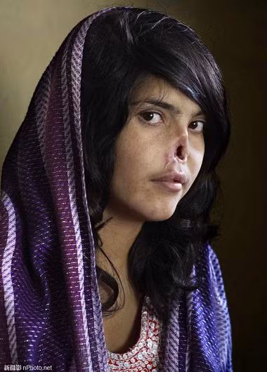 2010: Bibi Aisha, cô gái 18 tuổi ở tỉnh Oruzgan, Afghanistan bị đuổi về nhà cha mẹ đẻ sau khi bị nhà chồng hành hạ tàn nhẫn