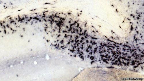 Microglia, màu đen, bắt đầu ăn arginine