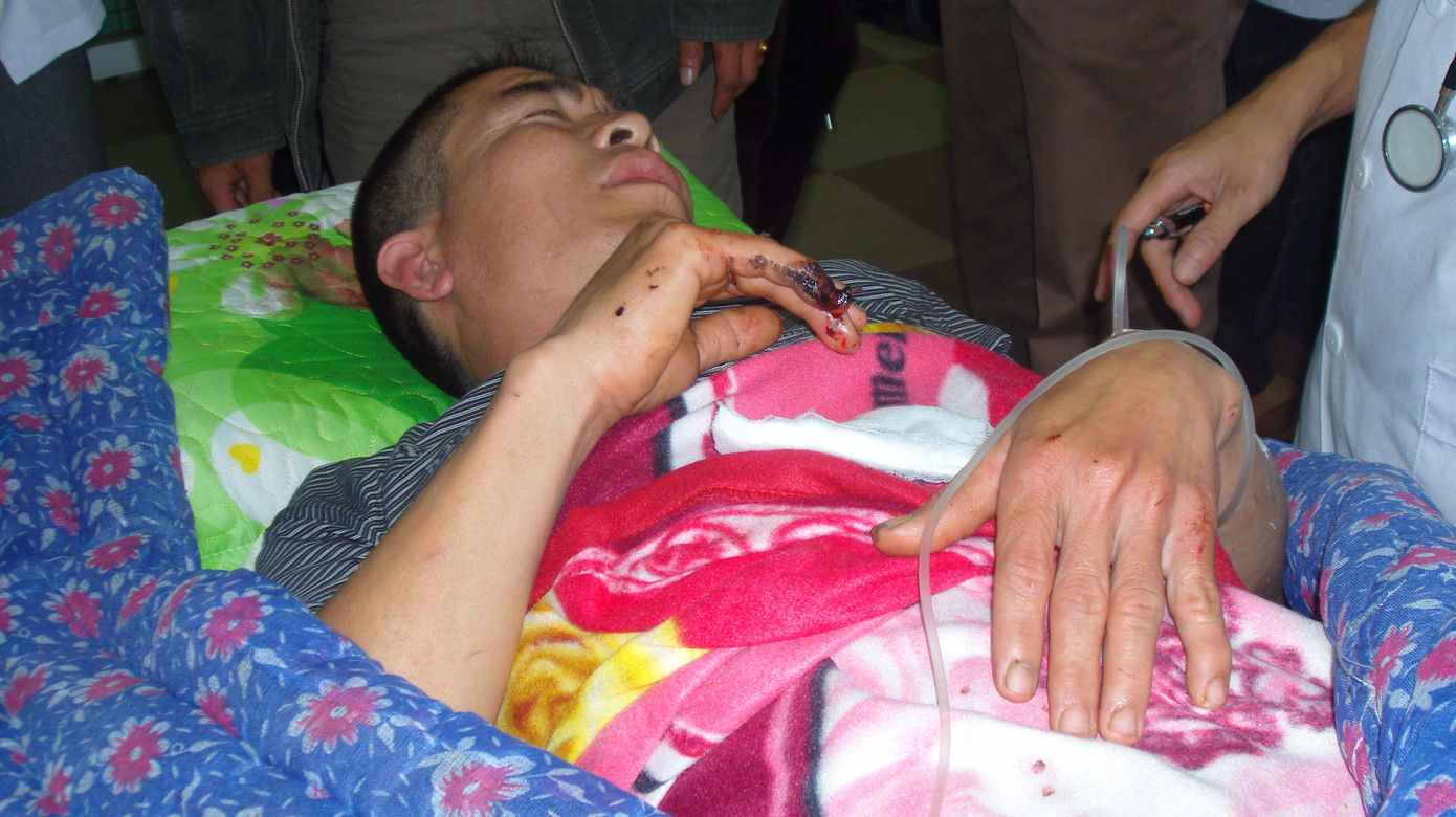 Anh Nguyễn Văn Thìn (35 tuổi) đang được các BS BV Đa khoa Nghệ An cấp cứu.