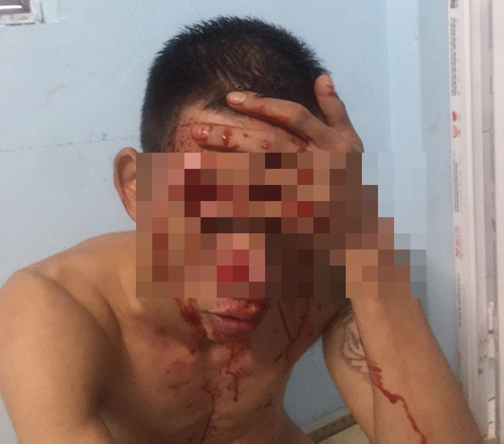 Lý dùng tiết lợn bôi trên người, chụp ảnh gửi về gia đình Lý dùng tiết lợn bôi trên người, chụp ảnh gửi về gia đình