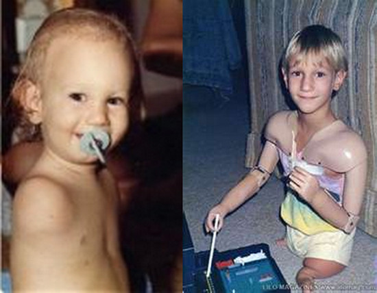 Nick Vujicic sinh ngày 4/121982 tại Australia. Từ lúc chào đời anh đã không có tay lẫn chân hoàn chỉnh. Tất cả hoạt động của anh đều được thực hiện bởi một mẩu chân nhỏ bên trái. Ảnh: Bruno