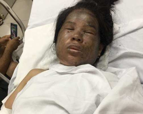 Bình gas phát nổ, gia đình 4 người cháy đen ảnh 1