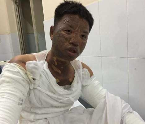 Bình gas phát nổ, gia đình 4 người cháy đen ảnh 3