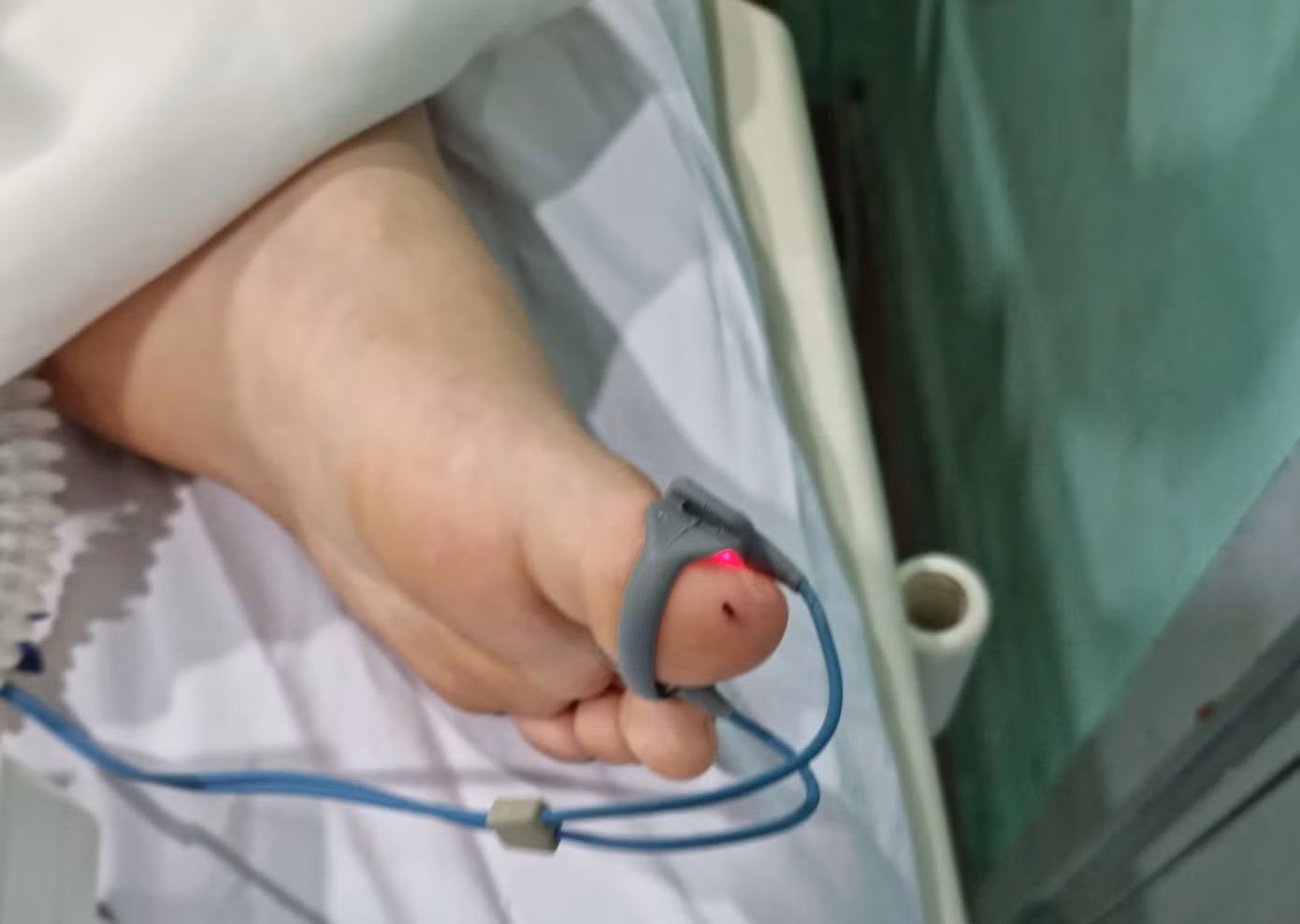 Vết bỏng trên chân cháu N.S.T. Vết bỏng trên chân cháu N.S.T.